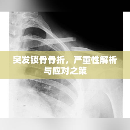 突發(fā)鎖骨骨折，嚴(yán)重性解析與應(yīng)對(duì)之策