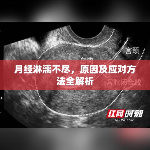 月經(jīng)淋漓不盡，原因及應(yīng)對方法全解析